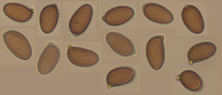 Agaricus crocodilinus